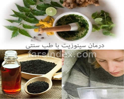 درمان سینوزیت در طب سنتی / درمان سینوزیت دکتر روازاده / درمان سینوزیت دکتر خیراندیش / درمان سینوزیت تبریزیان