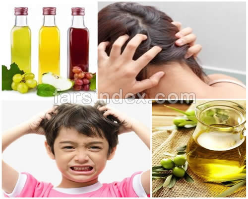 خارش سر (خارش پوست سر) / خارش پوست سر / علت خارش سر در طب سنتی / درمان خانگی خارش سر / درمان گیاهی خارش سر / درمان خارش سر با سرکه / شامپوی مناسب برای خارش سر / بهترین شامپو برای خارش سر / علت خارش سر در کودکان و درمان خارش سر (خارش پوست سر) / خارش پوست سر / علت خارش سر در طب سنتی / درمان خانگی خارش سر / درمان گیاهی خارش سر / درمان خارش سر با سرکه / شامپوی مناسب برای خارش سر / بهترین شامپو برای خارش سر / علت خارش سر در کودکان و درمان