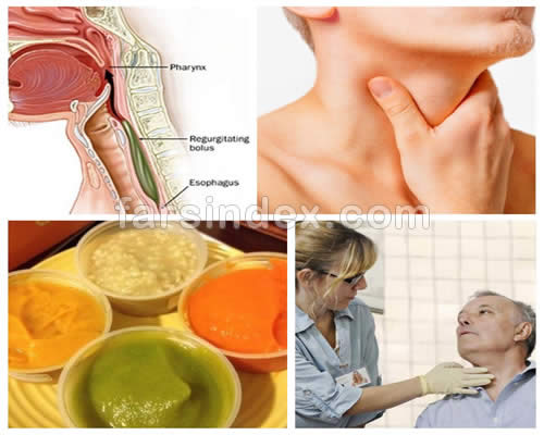 دیسفاژی / اختلال بلع / مشکل بلع / دیسفاژی مری / دیسفاژی عصبی / انواع دیسفاژی / علائم دیسفاژی / درمان دیسفاژی / درمان گیاهی دیسفاژی / درمان دارویی دیسفاژی / اودینوفاژی / اودینوفاژی چیست