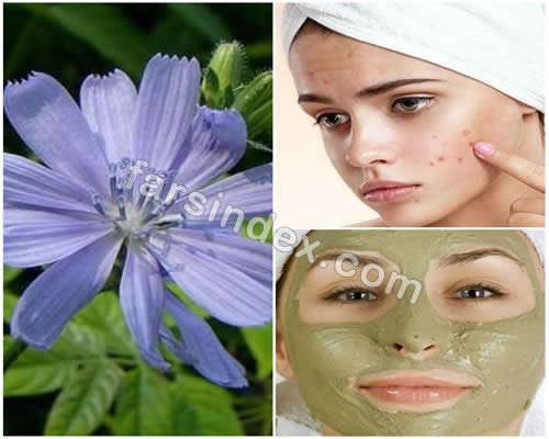 درمان آکنه با طب سنتی / درمان جوش در طب سنتی / نسخه های رایج طب سنتی برای درمان جوش و آکنه