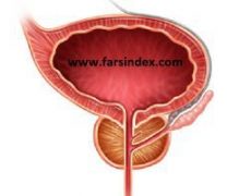 غده پروستات / کار پروستات چیست / آزمایش پروستات غده پروستات / کار پروستات چیست / آزمایش پروستات